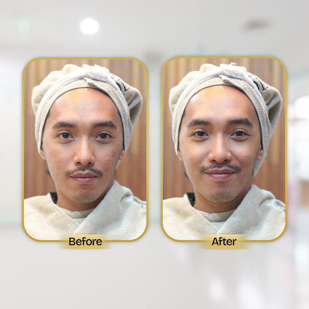 Before and After Treatment