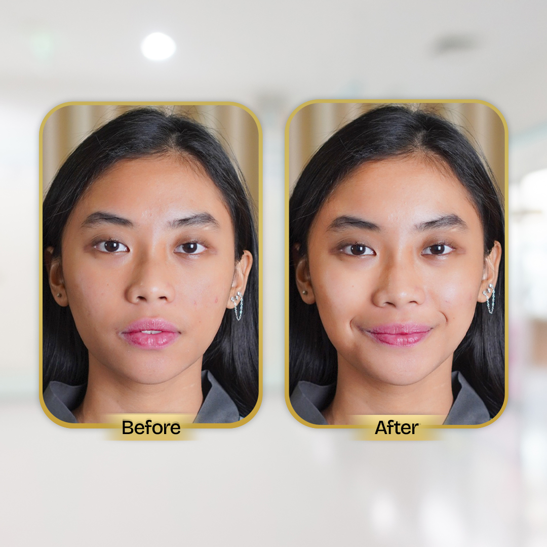 Before and After Treatment