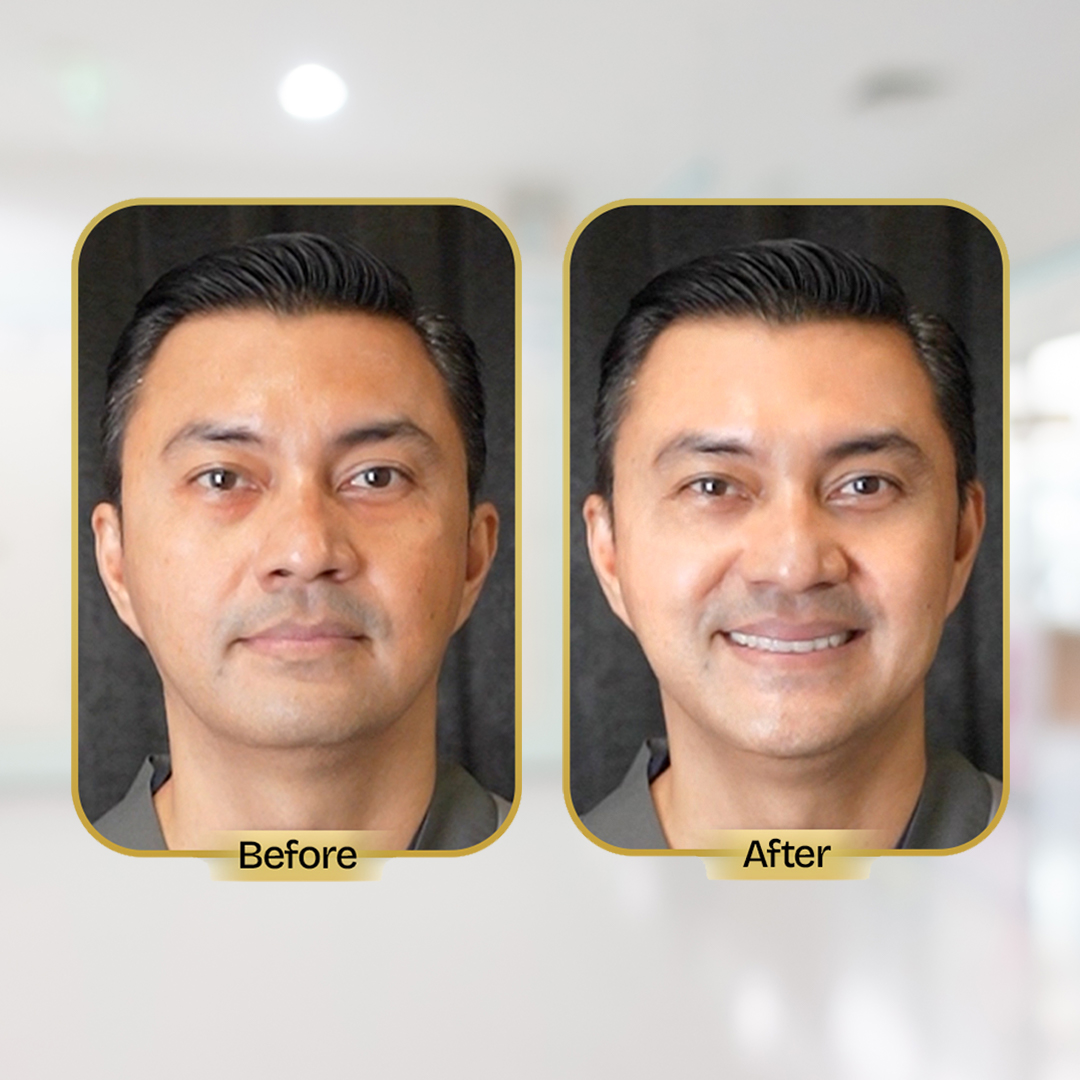 Before and After Treatment