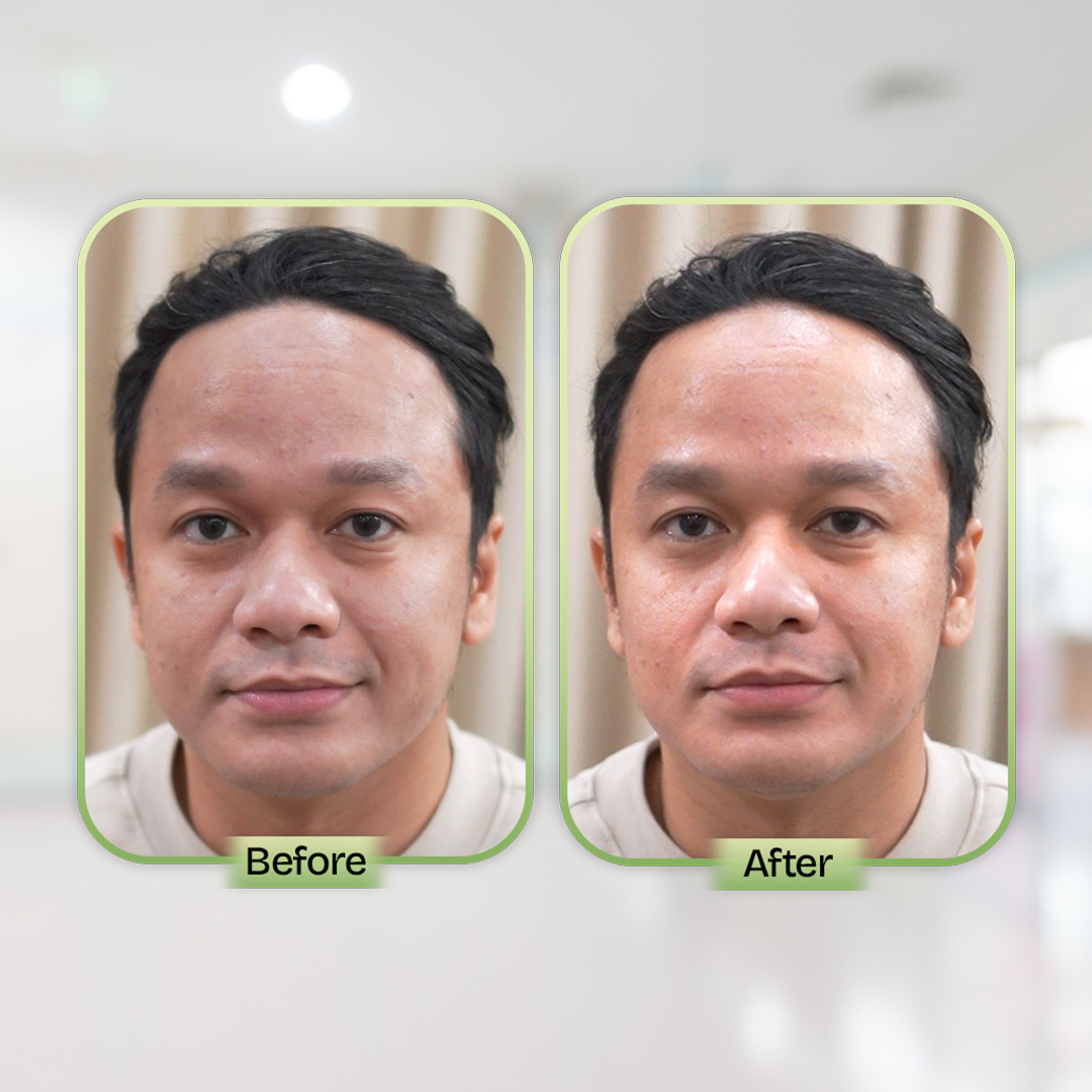 Before and After Treatment