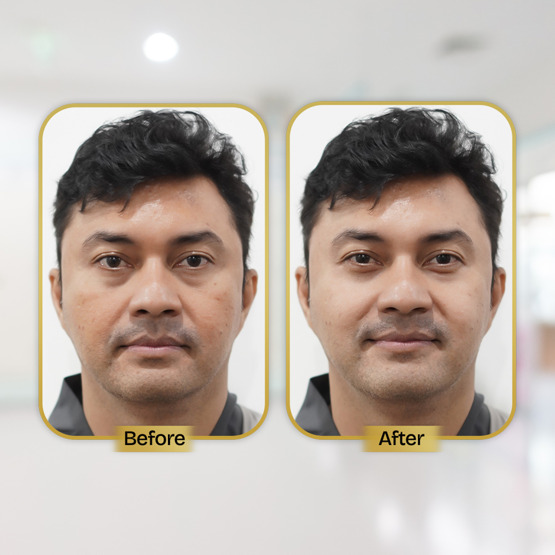 Before and After Treatment